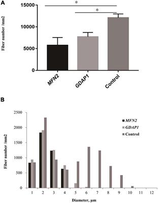 The Pathological Features of Common Hereditary Mitochondrial Dynamics Neuropathy